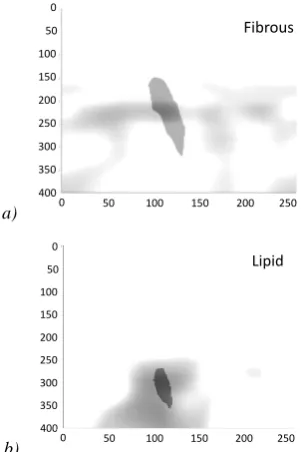 Fig. 12.  Soft-Decision Results from the tissue characterization of the Fibrous (a) and Lipid (b) ROI by using the COG Model with a threshold used: Th = 30