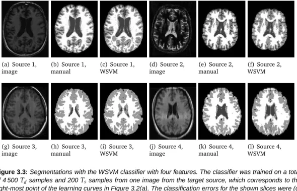 Figure 3.3: Segmentations with the WSVM classifier with four features. The classifier was trained on a total of 4 500 T d samples and 200 T s samples from one image from the target source, which corresponds to the right-most point of the learning curves in