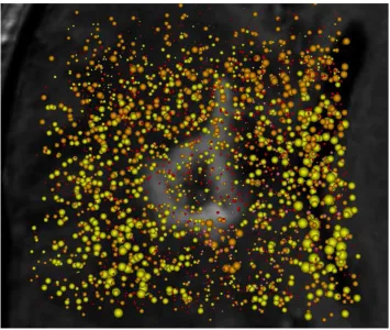 Figure 4.3: SDDS visualization of MRI and MRS data of the brain. The lesion is shownin gray in the background