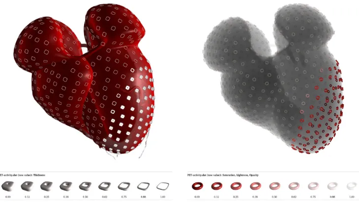 Figure 4.4: Cardiac wall motion and activity shown using surface glyphs. (a) PET/CTdata represented using DVR, with thickness modulated to show regions of low PETactivity (b) X-ray simulation of PET/CT data with a combination of saturation, lightnessand op