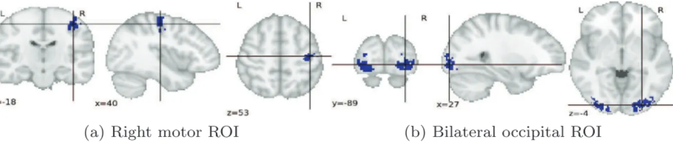 Fig. 13. Consecutive slices of the estimated parcellation located in the right motor cortex.