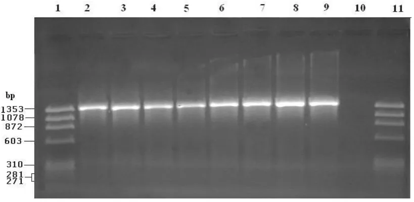 Table 1 Distribution of Ziehl-Neelsen and Culture Positive cases among 140 samples suspected for Mycobacterium