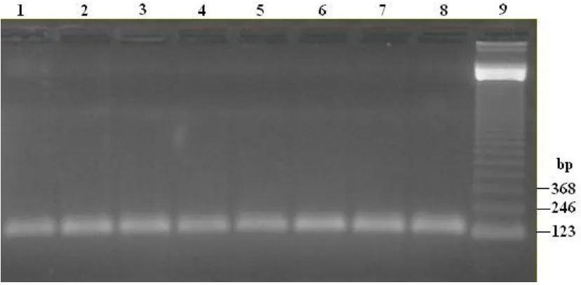 Figure 3. PCR assay using primer mix A for differentiation of Mycobacterium tuberculosis complex (MTB) and nontuberculous mycobacteria (NTM)