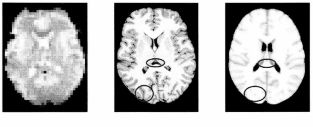 Figure 2.2:  One slice of functional  image, structural image and MNI atlas. 