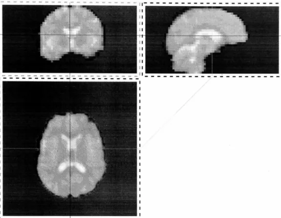 Figure 3.3:  Different parts of brain corresponding to  different p arts  of histogram