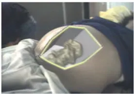 Figure 7.9   Virtual pregnant patient (State et al. 1996) 