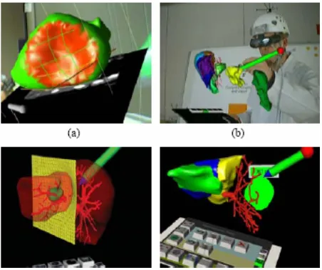 Figure 7.10   These images show Liver-Surgery planning using AR. 