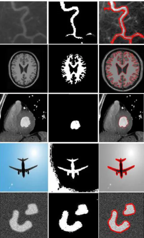 Figure  3  Simulation result for different kinds of images, the columns from left to right: original image, result of KFCM, result of proposed approach in red