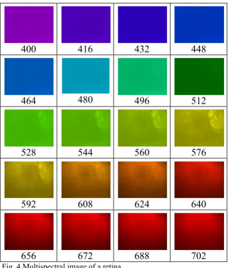 Fig. 4 Multispectral image of a retina 