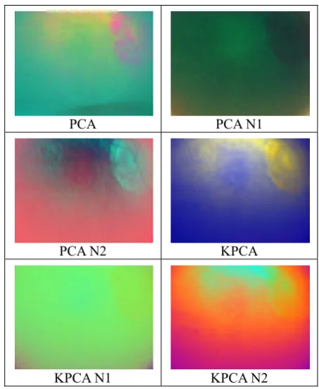 Fig. 8.  Dimensionality reduction results of the eye multispectral image from Fig. 3  (PCA – Principal Component Analysis, KPCA Kernel Principal Component Analysis with Polynomial Kernel, N1 – Normalization N1, N2 Normalization N2) 