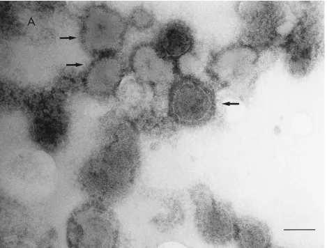 FIG. 2. Electron micrographs showing negatively stained WT L-particles (A) and ambUL8 PREPs (B)