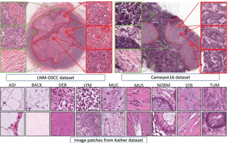 Fig. 3. Exemplar images of different datasets that are used in this study. Red and green boxes denote the tumor and normal image patches.