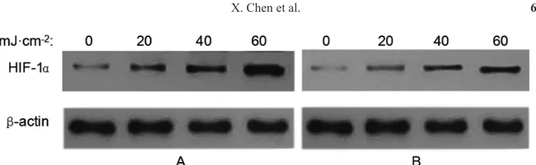 Figure 1. Protein expression of hypoxia-inducible factor-1α in the control and Shenqin biochemical extract-treated groups after ultraviolet B irradiation