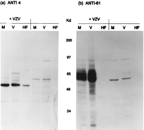 FIG. 1. Immunoreactivities of monospeciﬁc antibodies to the fusion proteinproducts of VZV ORF 63 (a), ORF 4 (b), and ORF 61 (c) with polypeptides