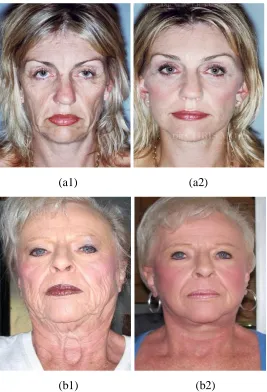 Figure 1.1 Pre-surgery (a1-b1) and post-surgery (a2-b2)  images of different 