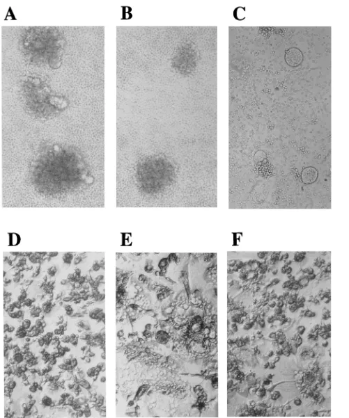FIG. 4. Syncytium induction by HIV-1DH12(approximately 3to HIV-1 in various cell types