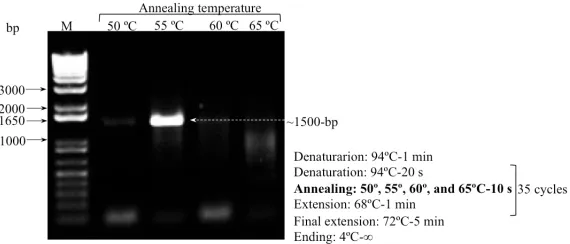 Figure 2. Gel electrophoresis was performed for PCR product from the plasmid [MaSp1]8_pMK-RQ obtained by using the custom PCR program; details on the right side of the image