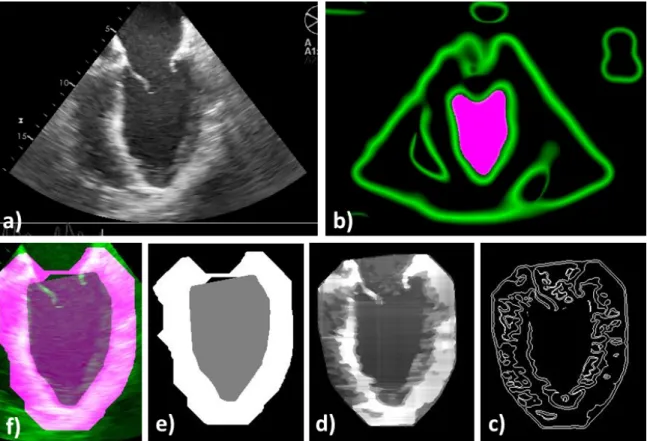 Figure 2.1: Segmentation Workflow: a) original US image, (b) high spread (σ) low frequency monogenic filter applied to the “2D + time” image dataset shown with the high confidence blood pool mask, (c) low spread (σ) high frequency monogenic filter output w
