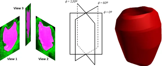 Figure 2.4: Schematic illustration of the 3D LV reconstruction: the tri-plane views at 60 ◦ (a) are inserted at their appropriate orientation (b), followed by spline  inter-polation and convex hull generation (c).