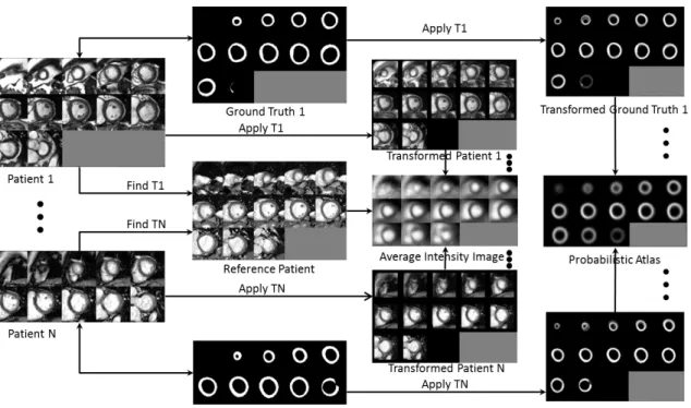 Figure 3.1: All patient images are affinely registered to the reference patient, and the obtained optimum transformation is applied to the corresponding ground truth images