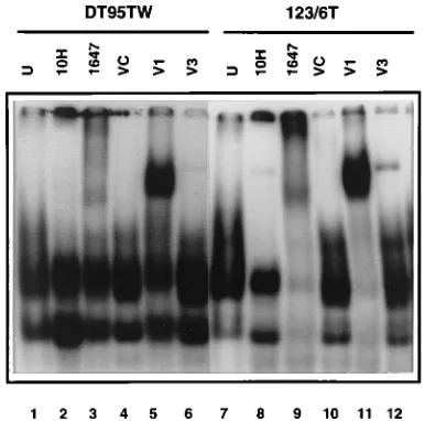 FIG. 1. �B DNA-binding complexes in cytoplasmic and nuclear extracts in Rel-transformed cell lines
