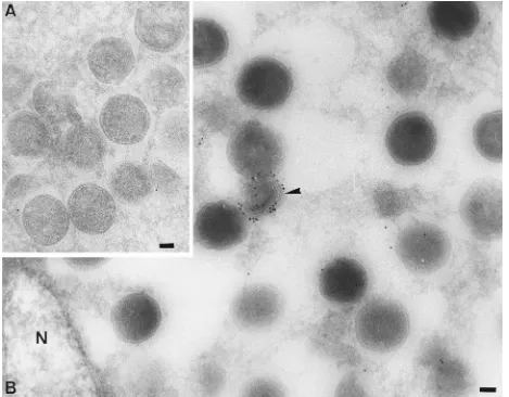 FIG. 8. EM immunolocalization of p14 in vaccinia virus-infected HeLa cells at 8 h postinfection