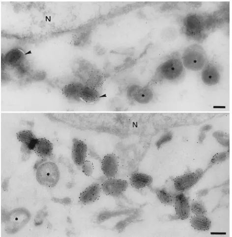 FIG. 10. Labelling of SLO-permeabilized, vaccinia virus-infected HeLa cells at 8 h postinfection with anti-p14 antibody