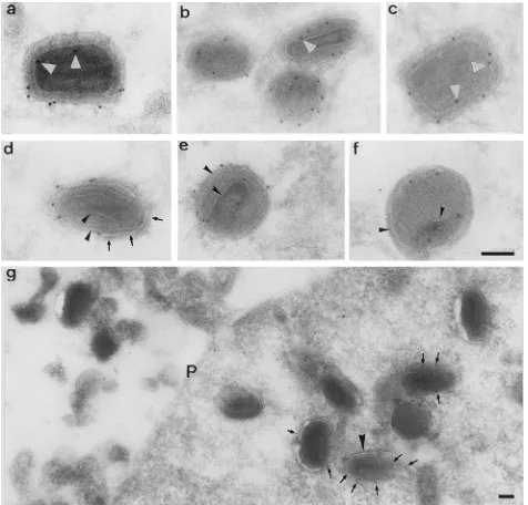 FIG. 2. EM immunogold localization of p32. Cryosections of vaccinia virus-infected HeLa cells at 8 h postinfection were labelled with anti-p32 antibody followedby protein A-gold