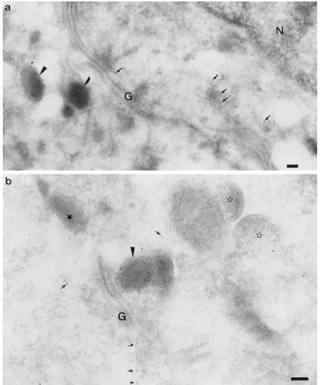 FIG. 3. Labelling for p32 in the perinuclear region of HeLa cells at 8 h postinfection