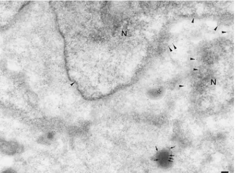 FIG. 4. Low-magniﬁcation image of HeLa cells at 8 h postinfection labelled for p32. Note the label that is preferentially associated with the nuclear envelope (N,nucleus [arrowheads]) as well as scattered in the cytoplasm