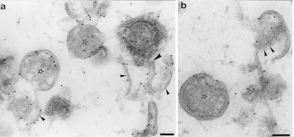 FIG. 5. Labelling of thawed cryosections of SLO-permeabilized HeLa cells at 8 h postinfection with p32