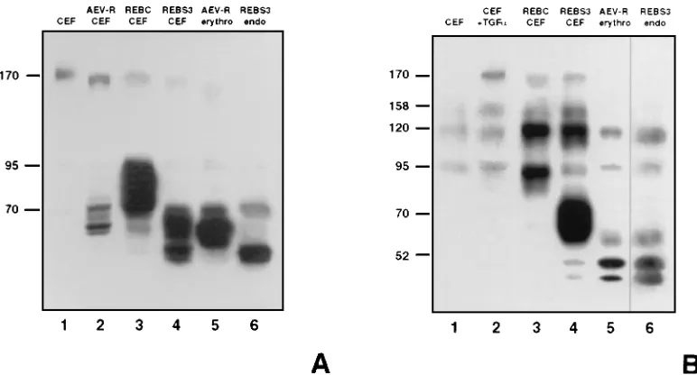 FIG. 2. Western immunoblot analysis of v-ErbB expression and tyrosine phosphorylation in normal and retrovirus-infected cells