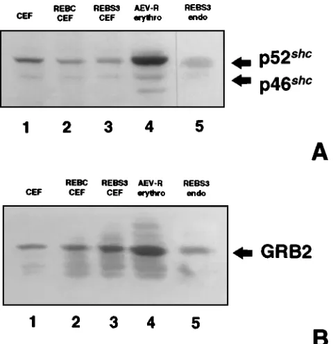 FIG. 6. Expression of the signal adapter proteins SHC and GRB-2 in 100 �were blotted with monoclonal anti-GRB-2 antibody and detected with HRP-conjugated anti-mouse antibody and ECL