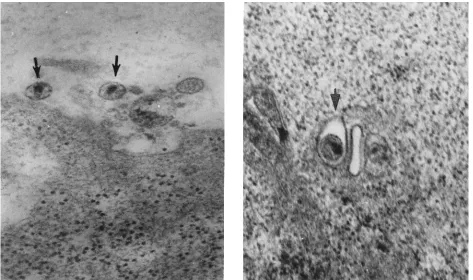 FIG. 8. Immunocapture of nascent viral DNA-associated particles by anti-HIV-1 gp120 and gp41 antibodies