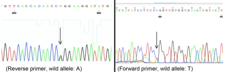 Figure 1. Electropherogram showing the mutation c.5324 T>C (L1775P). Reverse primer, wild allele: A; Forward primer, wild allele: T.