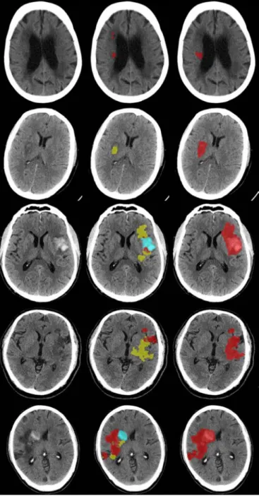 Figure 3  Sample results. from left to right we have input image, union  of the segmentation results, and reference segmentation