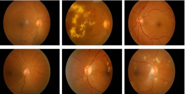 Fig. 2 Examples of images in the dataset. Macula centre. Optic disc centre