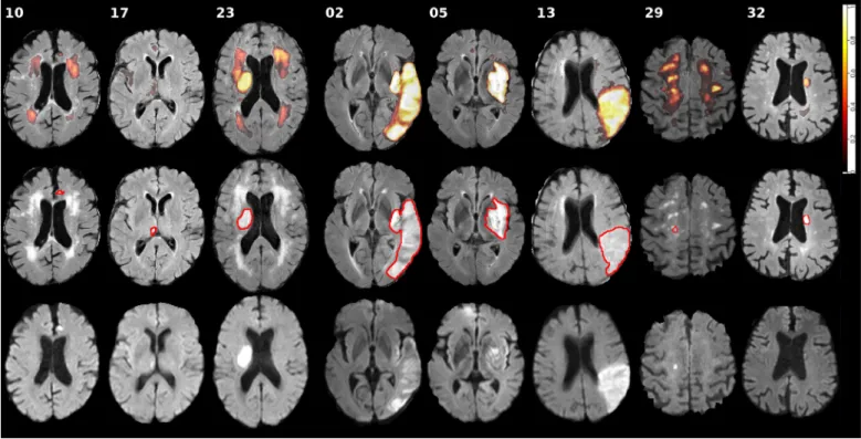 Fig. 7. Visual results for selected diﬃcult (10, 17, 23), easy (2, 5, 13), and second center (29, 32) cases from the SISS testing dataset