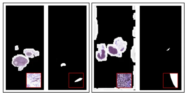 Figure 2.1: Whole slide image(WSI) and ground-truth mask of Camelyon17 dataset. [1]