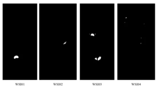 Figure 2.2: Tumor areas (white) and normal areas (black) in binary ground-truth masks from 4 different WSIs.