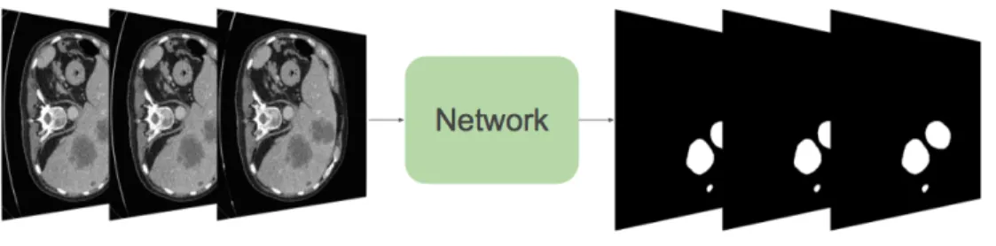 Figure 3.3: In the input of the network 3 consecutive slices are stacked, and at the output, the 3 slices are segmented