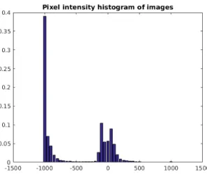 Figure 4.1: Pixel intensity histogram of images from LiTS dataset.