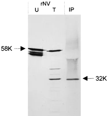 FIG. 2. Immunoprecipitation and Western blot detection of NV-speciﬁc sol-uble protein from stool extracts