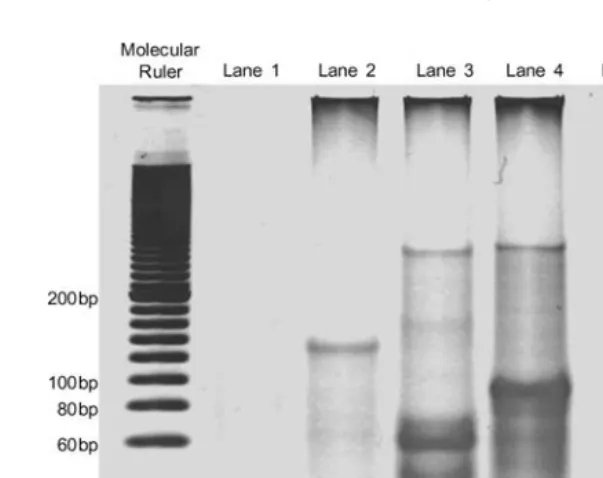 FIGURE 7An example of the output of gel electrophoresis.
