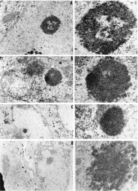 FIG. 6. Electron photomicrographs of intranuclear dense bodies obtained by conventional electron microscopy