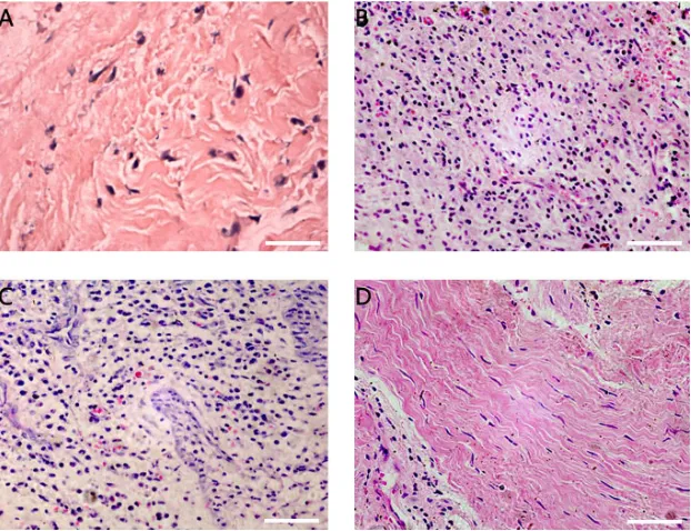 Figure 1. Results from histological analysis. A. Healthy control group; B. periapical granulomas group; C