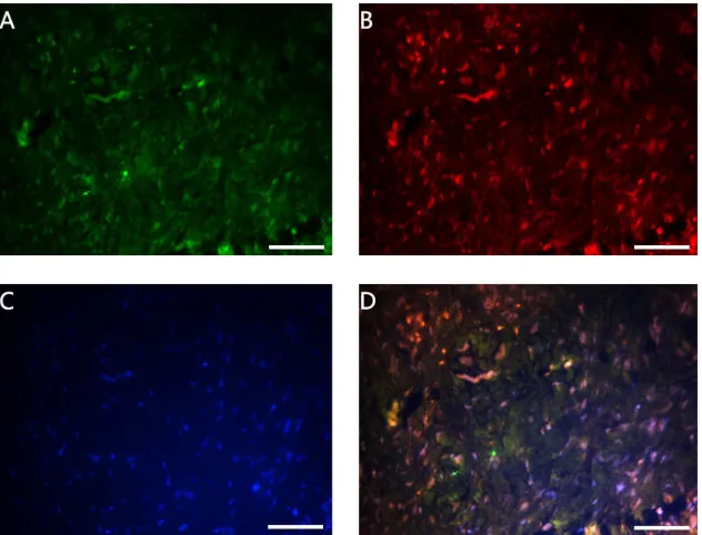 Figure 2. Double immunofluorescence results of fibroblasts in the healthy control group