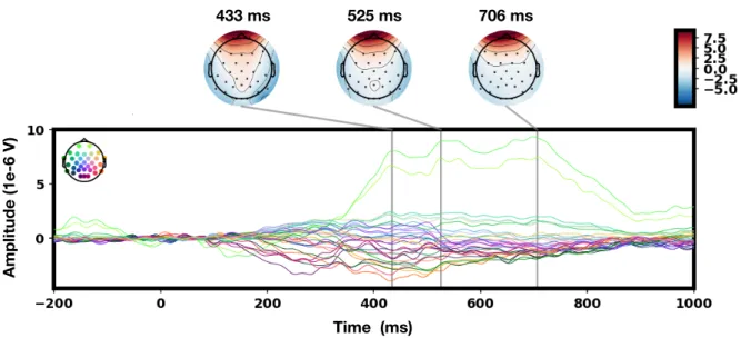 Figure 2.5: An example of eye-related artifacts present in EEG.