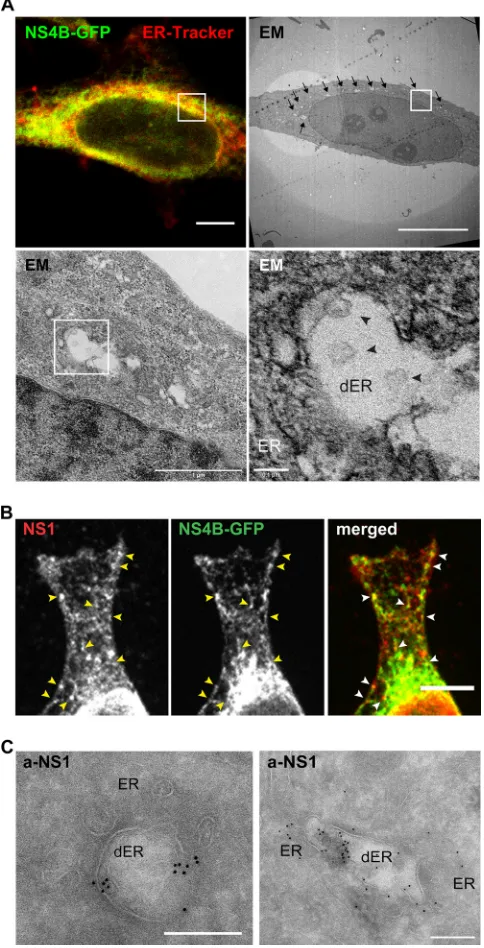 FIG 4 Localization of NS proteins in RC-like structures in NSP-GFP cells. (A) CLEM images of a NSP-GFPcell induced with dox