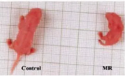 Fig. 1a:  Differences in size of the neonateof Control and MR along with placenta